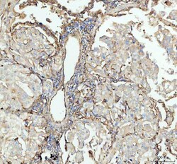 Invitrogen ICAM-1 (CD54) Polyclonal Antibody 100 &mu;g; Unconjugated:Antibodies,