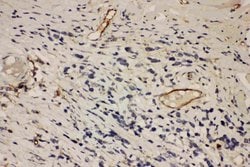 ICAM-1 (CD54) Polyclonal Antibody, Invitrogen 100 &mu;g; Unconjugated:Antibodies,