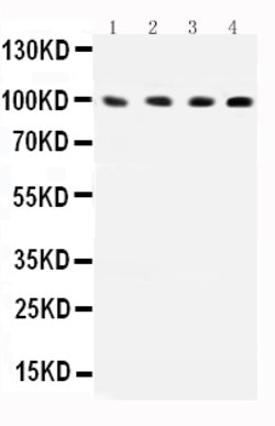ICAM-1 (CD54) Polyclonal Antibody, Invitrogen 100 &mu;g; Unconjugated:Antibodies,