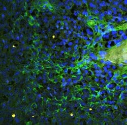 Invitrogen ICAM-1 (CD54) Polyclonal Antibody 100 &mu;g; Unconjugated:Antibodies,