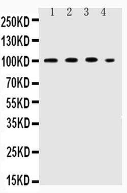 Invitrogen ICAM-1 (CD54) Polyclonal Antibody 100 &mu;g; Unconjugated:Antibodies,