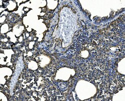 Invitrogen ICAM-1 (CD54) Polyclonal Antibody 100 &mu;g; Unconjugated:Antibodies,