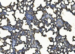 Invitrogen ICAM-1 (CD54) Polyclonal Antibody 100 &mu;g; Unconjugated:Antibodies,