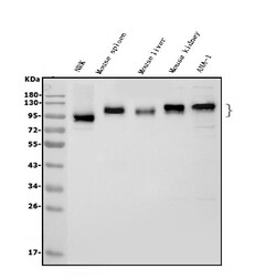 Invitrogen ICAM-1 (CD54) Polyclonal Antibody 100 &mu;g; Unconjugated:Antibodies,