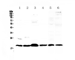 Invitrogen ICOS (CD278) Polyclonal Antibody 100 &mu;g; Unconjugated:Antibodies,