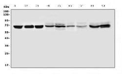 Invitrogen IFNAR1 Polyclonal Antibody 100 &mu;g; Unconjugated:Antibodies,