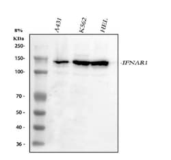 Invitrogen IFNAR1 Polyclonal Antibody 100 &mu;g; Unconjugated:Antibodies,