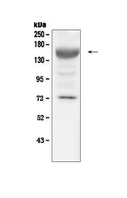 Invitrogen IGF1R (CD221) Polyclonal Antibody 100 &mu;g; Unconjugated:Antibodies,