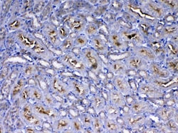 Invitrogen IGF1R (CD221) Polyclonal Antibody 100 &mu;g; Unconjugated:Antibodies,