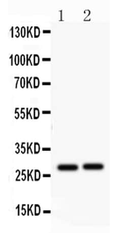 Invitrogen IGFBP-1 Polyclonal Antibody 100 &mu;g | Buy Online | Invitrogen&trade; | Fisher Scientific
