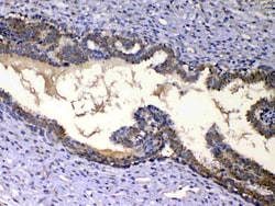 Invitrogen IGFBP2 Polyclonal Antibody 100 &mu;g; Unconjugated:Antibodies,