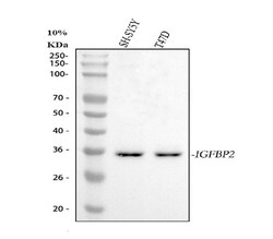 Invitrogen IGFBP2 Polyclonal Antibody 100 &mu;g; Unconjugated:Antibodies,