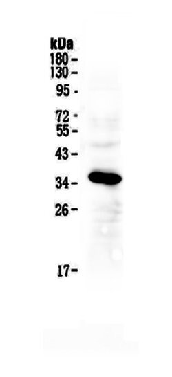 Invitrogen IGFBP2 Polyclonal Antibody 100 &mu;g; Unconjugated:Antibodies,
