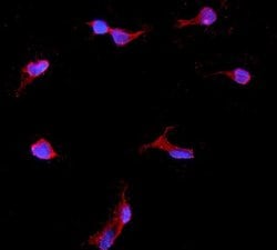 Invitrogen IGFBP2 Polyclonal Antibody 100 &mu;g; Unconjugated:Antibodies,