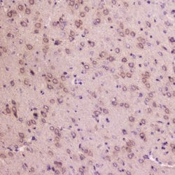 Invitrogen IGFBP2 Polyclonal Antibody 100 &mu;g; Unconjugated:Antibodies,