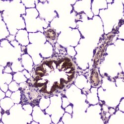 Invitrogen IGFBP2 Polyclonal Antibody 100 &mu;g; Unconjugated:Antibodies,