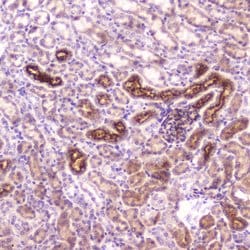 Invitrogen IGFBP2 Polyclonal Antibody 100 &mu;g; Unconjugated:Antibodies,