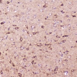Invitrogen IGFBP2 Polyclonal Antibody 100 &mu;g; Unconjugated:Antibodies,