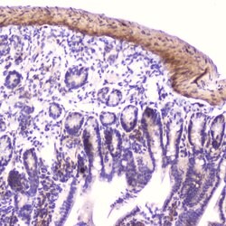 Invitrogen IGFBP2 Polyclonal Antibody 100 &mu;g; Unconjugated:Antibodies,