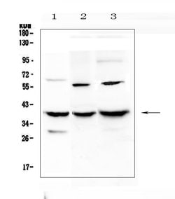 Invitrogen IGFBP2 Polyclonal Antibody 100 &mu;g; Unconjugated:Antibodies,