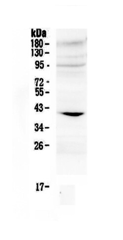 Invitrogen IGFBP3 Polyclonal Antibody 100 &mu;g; Unconjugated:Antibodies,