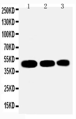 IHH Polyclonal Antibody, Invitrogen 100 &mu;g; Unconjugated:Antibodies,