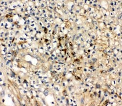 Invitrogen IL-10 Polyclonal Antibody 100 &mu;g; Unconjugated:Antibodies,