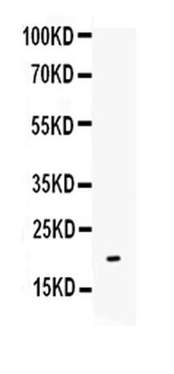 Invitrogen IL-10 Polyclonal Antibody 100 &mu;g; Unconjugated:Antibodies,
