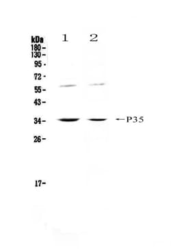 Invitrogen IL-12 p35 Polyclonal Antibody 100 &mu;g; Unconjugated:Antibodies,