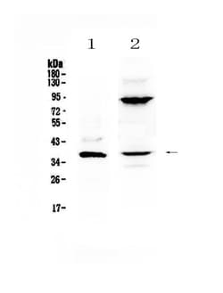 Invitrogen IL-12 p40 Polyclonal Antibody 100 &mu;g; Unconjugated:Antibodies,