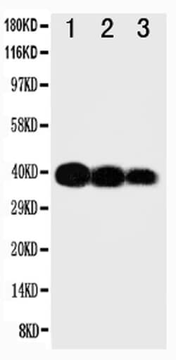 Invitrogen IL-12 p40 Polyclonal Antibody 100 &mu;g; Unconjugated:Antibodies,