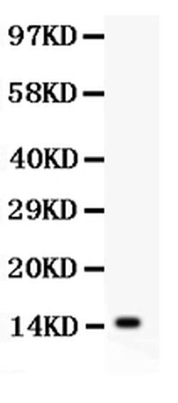 Invitrogen IL-15 Polyclonal Antibody 100 &mu;g; Unconjugated:Antibodies,