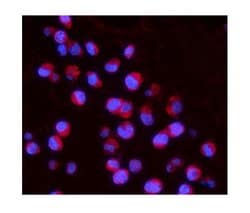 Invitrogen IL15RA Polyclonal Antibody 100 &mu;g; Unconjugated:Antibodies,