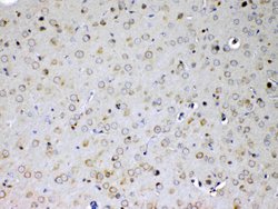 Invitrogen IL15RA Polyclonal Antibody 100 &mu;g; Unconjugated:Antibodies,