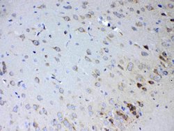 Invitrogen IL15RA Polyclonal Antibody 100 &mu;g; Unconjugated:Antibodies,
