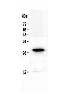 Invitrogen IL15RA Polyclonal Antibody 100 &mu;g; Unconjugated:Antibodies,