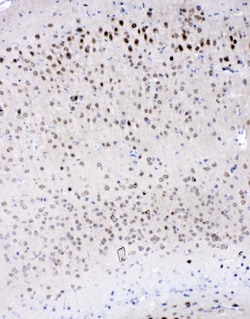 Invitrogen IL-16 Polyclonal Antibody 100 &mu;g | Buy Online | Invitrogen&trade; | Fisher Scientific