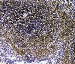 Invitrogen IL-16 Polyclonal Antibody 100 &mu;g | Buy Online | Invitrogen&trade; | Fisher Scientific
