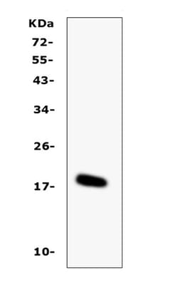 Invitrogen IL-16 Polyclonal Antibody 100 &mu;g | Buy Online | Invitrogen&trade; | Fisher Scientific