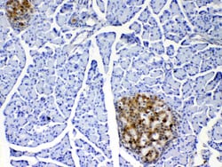 Invitrogen IL-17A Polyclonal Antibody 100 &mu;g; Unconjugated:Antibodies,