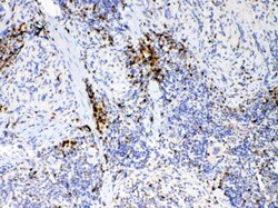 Invitrogen IL-17A Polyclonal Antibody 100 &mu;g; Unconjugated:Antibodies,