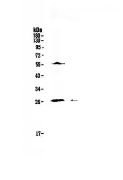 Invitrogen IL-17A Polyclonal Antibody 100 &mu;g; Unconjugated:Antibodies,