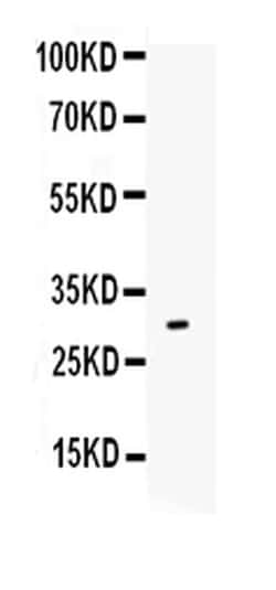 Invitrogen IL-17A Polyclonal Antibody 100 &mu;g; Unconjugated:Antibodies,