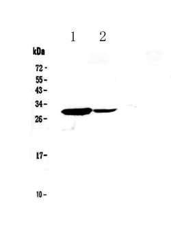 Invitrogen IL17C Polyclonal Antibody 100 &mu;g; Unconjugated:Antibodies,