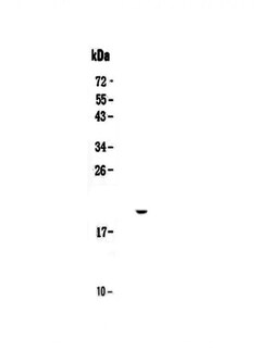 Invitrogen IL17C Polyclonal Antibody 100 &mu;g | Buy Online | Invitrogen&trade; | Fisher Scientific