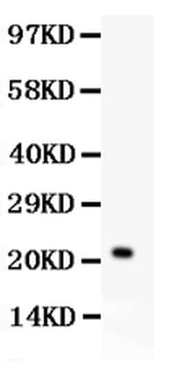 Invitrogen IL-18 Polyclonal Antibody 100 &mu;g; Unconjugated:Antibodies,