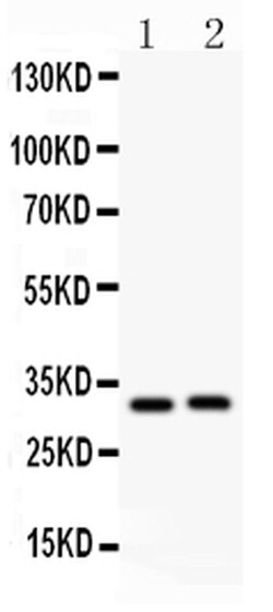 Invitrogen IL-1 beta Polyclonal Antibody 100 &mu;g; Unconjugated:Antibodies,