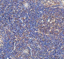 Invitrogen IL-1 beta Polyclonal Antibody 100 &mu;g; Unconjugated:Antibodies,