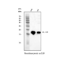 Invitrogen IL-1 beta Polyclonal Antibody 100 &mu;g; Unconjugated:Antibodies,