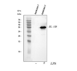 Invitrogen IL-1 beta Polyclonal Antibody 100 &mu;g; Unconjugated:Antibodies,